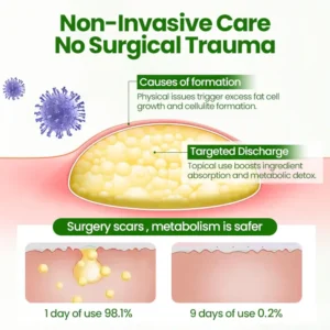KnotAway Lipoma Removal Cream - Image 7