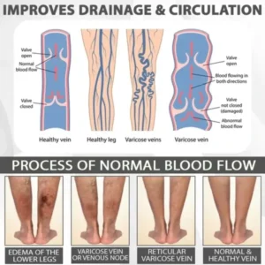 EdemaRelief Lymphatic Detox Cream - Image 6