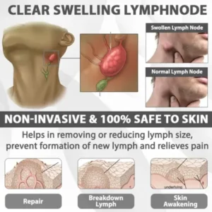 EdemaRelief Lymphatic Detox Cream - Image 7