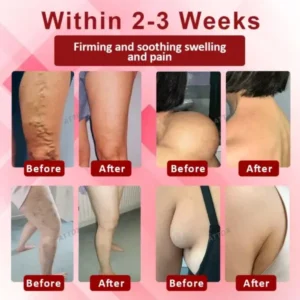 VenoLymph Massage Therapy Cream - Image 2