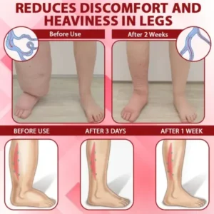 VenoLymph Massage Therapy Cream - Image 9