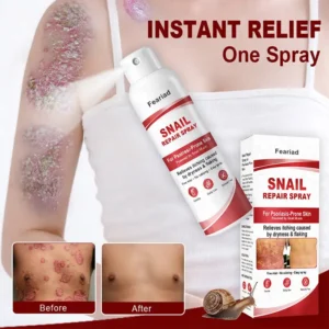 Feariad Snail Repair Spray for Itchy, Flaky Psoriasis Skin - Image 2