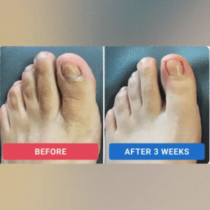 – Nail Repair Patches - Image 3