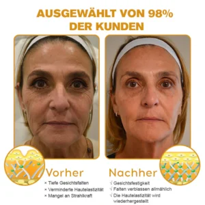 Botox Bienengift Faltenentfernungscreme - Image 10