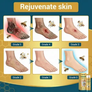 GlucoCare Bee Venom Diabetic Wound Spray - Image 2