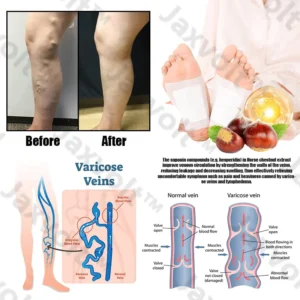 Natural Herbal Tourmaline Far Infrared Magnetic Therapy Foot Patches - Image 9