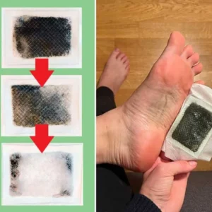 Detox Patches | Restore Balance & Wellness - Image 3