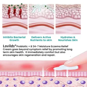 Probiotic + B 24-7 Moisture Eczema Relief Cream - Image 6
