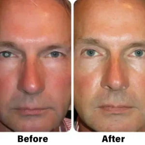 Nano Vision Repair Eye Serum - Image 11