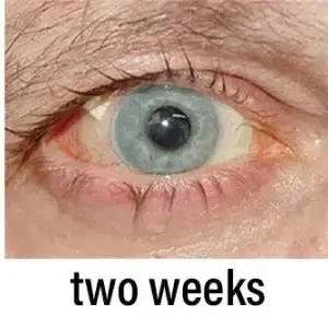Nano Vision Repair Eye Serum - Image 13