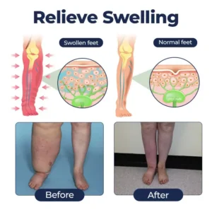 SwellRelief Circulation Support Cream - Image 3