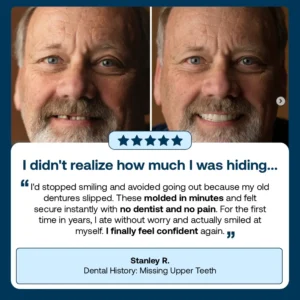 Full Denture with Strong Suctiond - Image 10