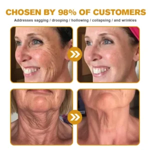 Botox Bee Venom Wrinkle Removal Cream - Image 8