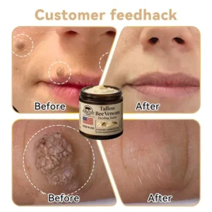Tallow Bee Venom Healing Balm - Image 10