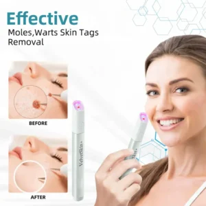 All-in-One CO₂ Laser Eraser Pen | Removes Moles, Warts, Skin Flaws & Pigmentation - Image 3