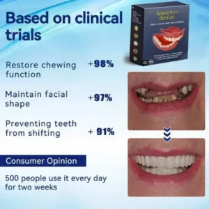 Adhesive teeth (upper and lower) - Image 6