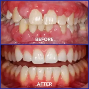 VioCore Bee Venom Dental Treatment Toothpaste - Image 6