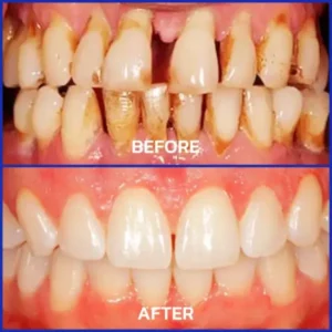 VioCore Bee Venom Dental Treatment Toothpaste - Image 7