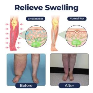 SwellRelief Circulation Support Cream - Image 6