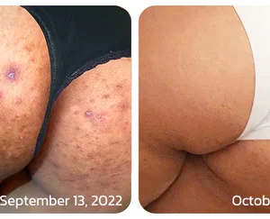 BodyTreat Collagen Exfoliating Essence - Image 7