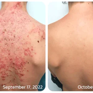 BodyTreat Collagen Exfoliating Essence - Image 3