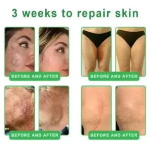 𝐀𝟏𝟎+ 𝟔-𝐢𝐧-𝟏 𝐃𝐞𝐫𝐦𝐚𝐑𝐞𝐩𝐚𝐢𝐫 𝐒𝐞𝐫𝐮𝐦 - Image 9