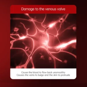 Varicose Veins Relief Cream - Image 2
