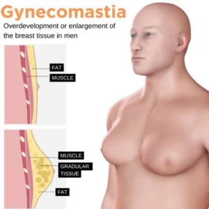 Gynecomastia Cream - Image 6