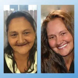 𝗙𝘂𝗻𝗰𝘁𝗶𝗼𝗻𝗮𝗹 𝗧𝗵𝗶𝗰𝗸𝗲𝗻𝗲𝗱 𝗗𝗲𝗻𝘁𝘂𝗿𝗲𝘀 - Image 11