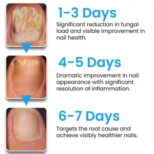 NanoFix Nail Repair Pen - Image 6