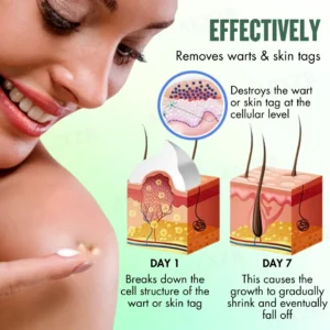 WartsOff Instant Blemish Removal Cream - Image 6