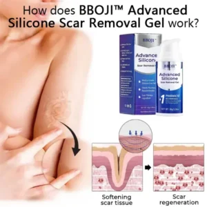 Advanced Silicone Scar Removal Gel - Image 3