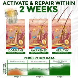 👱‍♂️ Microneedle Herbal Infusion Hair Stimulation Set 🇺🇸 Made in USA - Image 7