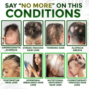 👱‍♂️ Microneedle Herbal Infusion Hair Stimulation Set 🇺🇸 Made in USA - Image 4