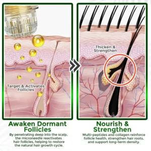 👱‍♂️ Microneedle Herbal Infusion Hair Stimulation Set 🇺🇸 Made in USA - Image 6
