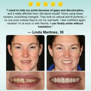 𝗜𝗻𝘀𝘁𝗮𝗻𝘁 𝗦𝘁𝗶𝗰𝗸-𝗼𝗻 𝗗𝗲𝗻𝘁𝗮𝗹 𝗩𝗲𝗻𝗲𝗲𝗿𝘀 (✅Clinically proven, easy-to-use dental veneers trusted by over 8,000 US users for a comfortable, natural smile.) - Image 3
