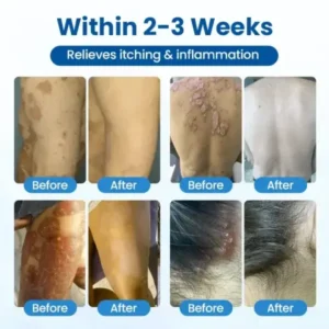PCA Magnesium Deep Repair Spray - Image 2