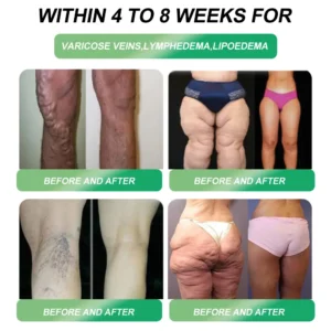 Weight Loss Drops - Image 13