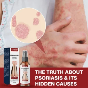 DermSoothe Psoriasis Relief Spray