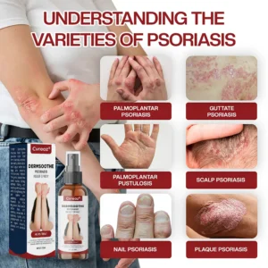 DermSoothe Psoriasis Relief Spray - Image 9