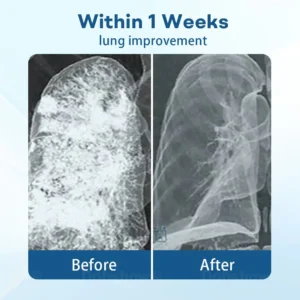 DoubleNano Advanced Lung Detox Patch for Relief - Image 3