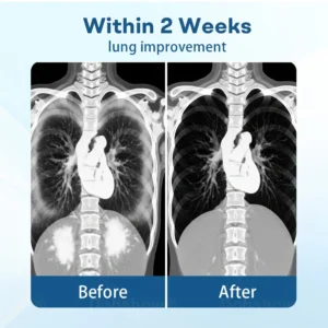 DoubleNano Advanced Lung Detox Patch for Relief - Image 4