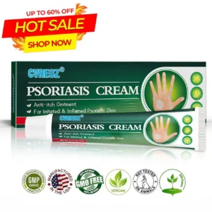 Knotaway Psoriasis Cream