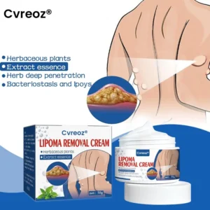 Lipoma Removal Cream
