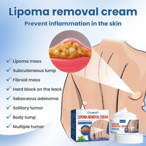 Lipoma Removal Cream - Image 4