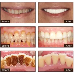 Niacinamide Intensive Whitening Toothpaste - Image 6