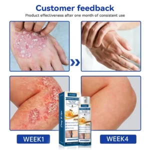 Psoriasis Heal Bee Venom Spray - Image 7