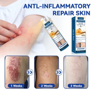 Psoriasis Heal Bee Venom Spray - Image 4