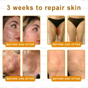 Bee Venom Skin Restoration Cream - Image 3