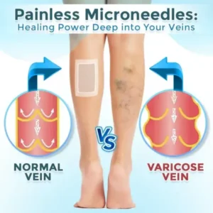 VenaRestore MicroNeedle Vein Repair Patch - Image 3
